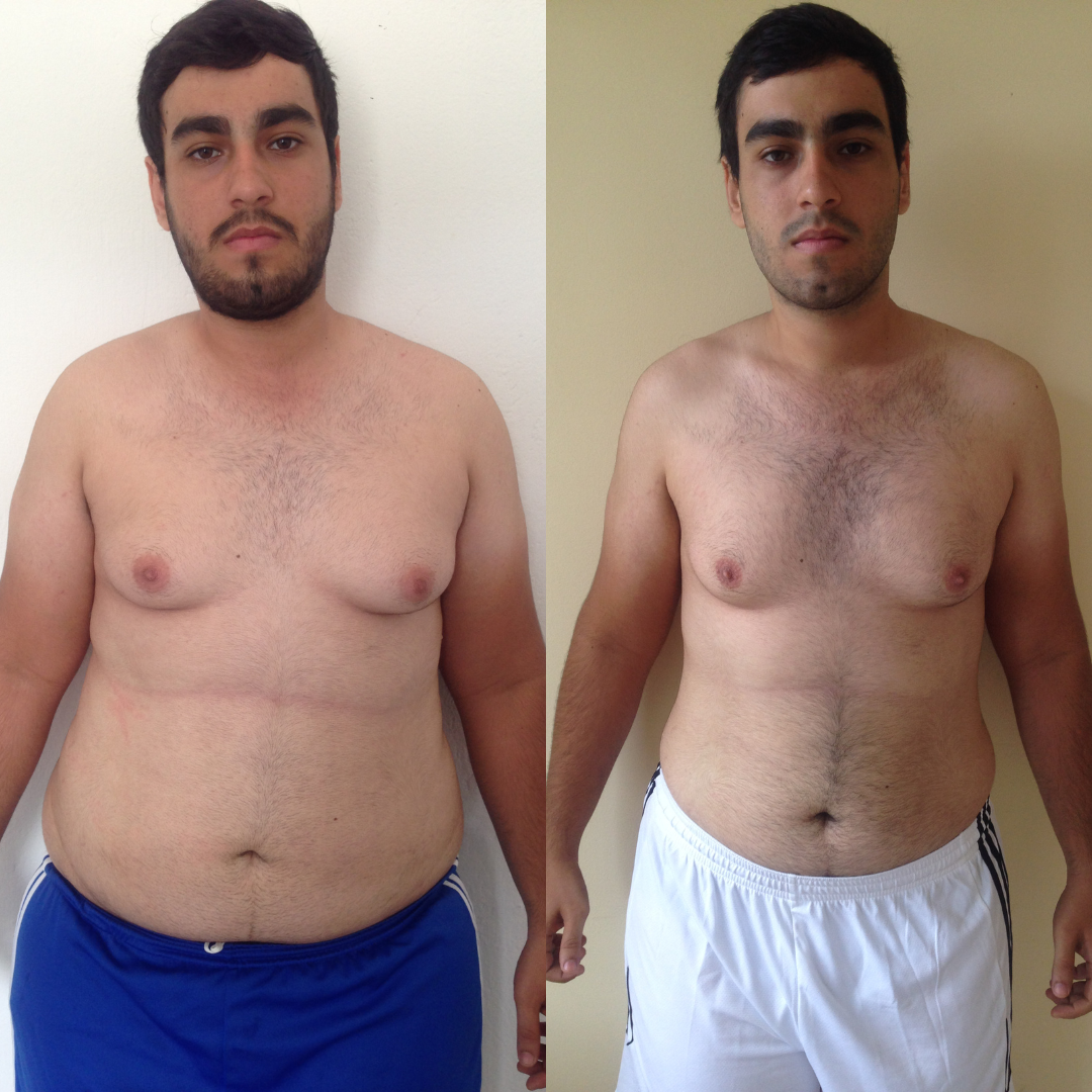 Antes e Depois